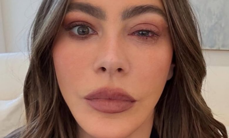 Sofia Vergara merindukan Emmy karena alergi mata, harus pergi ke ER Sofia Vergara merindukan Emmy karena alergi mata, harus pergi ke ER