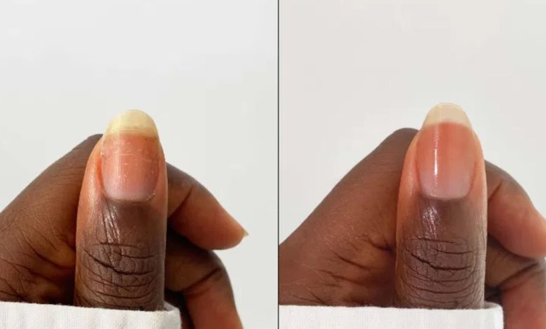 Ubah Kuku Rapuh dalam Dua Minggu Dengan Perawatan Ini Ubah Kuku Rapuh dalam Dua Minggu Dengan Perawatan Ini